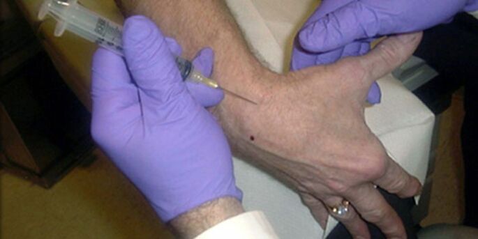 puncture le haghaidh pian i joints na méara